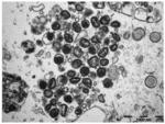 COMBINED USE OF SQUIRREL POXVIRUS AND MYXOMA POXVIRUS, FOR TREATING CANCER