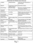 COMPOSITIONS FOR THE TREATMENT AND PREVENTION OF EYELID SWELLING