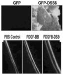 ANABOLIC TARGETING STEM CELL GENE THERAPY FOR OSTEOPOROSIS