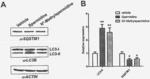 A SYNERGISTIC COMPOSITION AS A PROMOTER OF AUTOPHAGY