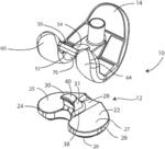 Modular knee prothesis