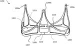 Devices and Methods for Surgical Valve Expansion