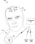 ADAPTIVE DEEP BRAIN STIMULATION USING FREQUENCY SUB-BANDS