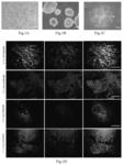 Method of committed differentiation of human induced pluripotent stem cells into Leydig cells and application of Leydig cells