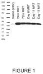 MESSENGER RNA THERAPY FOR THE TREATMENT OF ORNITHINE TRANSCARBAMYLASE DEFICIENCY