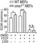 MITOCHONDRIAL PROTEASE OMA1 AS A MARKER FOR BREAST CANCER