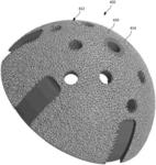 MEDICAL IMPLANT SURFACE TREATMENT AND METHOD