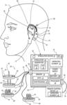 Auricular peripheral nerve field stimulator and method of operating same