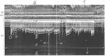 COMPUTER-IMPLEMENTED METHOD OF HANDLING ELECTROCARDIOGRAM DATA