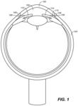 OCULAR DELIVERY SYSTEMS AND METHODS