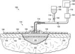 Apparatuses, methods, and compositions for the treatment and prophylaxis of chronic wounds