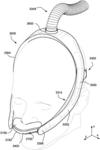 HEADGEAR TUBING FOR A PATIENT INTERFACE