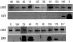 Pharmaceutical Composition Comprising Compound Capable of Penetrating Blood-Brain Barrier as Effective Ingredient for Preventing or Treating Brain Cancer