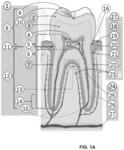 Periodontic treatment and method