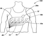 WEARABLE AMBULATORY MEDICAL DEVICE WITH MULTIPLE SENSING ELECTRODES