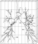 Systems and methods of registration for image guided surgery