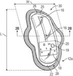 WEARABLE NON-INVASIVE LUNG FLUID MONITORING SYSTEM