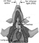 APPLICATION OF UV/FIR TO TREAT INFECTIONS IN THE RESPIRATORY TRACT