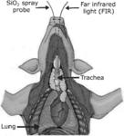 APPLICATION OF NANOPARTICLES TO TREAT INFECTIONS IN THE RESPIRATORY TRACT