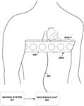 ASSESSING INTRA-CARDIAC ACTIVATION PATTERNS