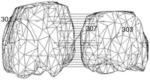 Computer-based method for measuring positional relationship between two teeth