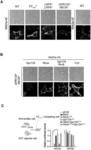 WNT SIGNALING AGONIST MOLECULES