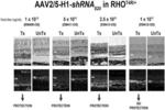 AAV VECTORS FOR TREATMENT OF DOMINANT RETINITIS PIGMENTOSA