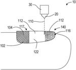 SYSTEMS AND METHODS FOR LASER-ASSISTED TOPICAL TREATMENT OF NAIL FUNGAL INFECTIONS