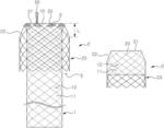 Stent having improved anti-migration function