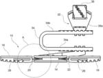 Foot for a robotic exoskeleton for assisted walking of persons suffering from locomotor disorders