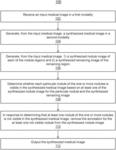 X-RAY IMAGE SYNTHESIS FROM CT IMAGES FOR TRAINING NODULE DETECTION SYSTEMS