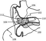 ACOUSTIC DAMPENING COMPENSATION SYSTEM