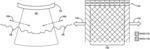 Ultrasound vibrometry with unfocused ultrasound