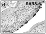 COMPOSITIONS AND METHODS FOR PREVENTING AND TREATING CORONAVIRUS INFECTION - SARS-COV-2 VACCINES