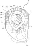 Method for determining whether a sealing area of a primary packaging container for an ophthalmic lens is unacceptable for properly sealing a foil thereto