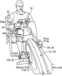 METHOD AND SYSTEM FOR USE OF TELEMEDICINE-ENABLED REHABILITATIVE EQUIPMENT FOR PREDICTION OF SECONDARY DISEASE