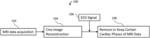 CARDIAC PHASE PREDICTION IN CARDIAC MRI USING DEEP LEARNING