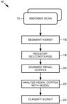 Computer aided diagnosis system for classifying kidneys