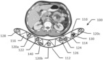 Quantification phantom for use with multiple imaging modalities