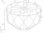 DEVICES AND METHODS FOR OCCLUSION OF AN ATRIAL APPENDAGE