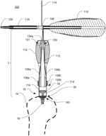 Delivery System for Articular Surface Implant