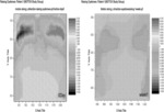 Methods useful in optimizing the treatment of neuropathies and targeting tissues with cosmetic botulinum injections