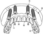 Method For Producing A Dental Prosthesis, Blank And Dental Prosthesis