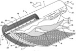 MEASUREMENT OF PRESSURE DIFFERENCES WITHIN A VESSEL OF SPIRAL WOUND MEMBRANE MODULES