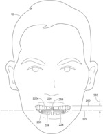 Radiographic Dental Jigs and Associated Methods