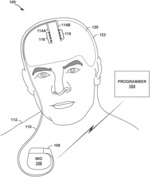 ELECTRODE MOVEMENT DETECTION