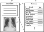 APPARATUS AND METHOD FOR PROCESSING MEDICAL IMAGE USING PREDICTED METADATA