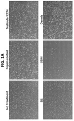 Extracellular matrix (ECM) hydrogel and soluble fraction thereof for the treatment of cancer
