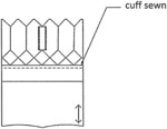 BIOLOGICAL LOW PROFILE, BALLOON EXPANDABLE PROSTHETIC HEART VALVE, PARTICULARLY AORTIC, FOR TRANSCATHETER IMPLANTATION AND THE METHOD OF ITS MANUFACTURING