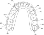 Orthodontic assembly